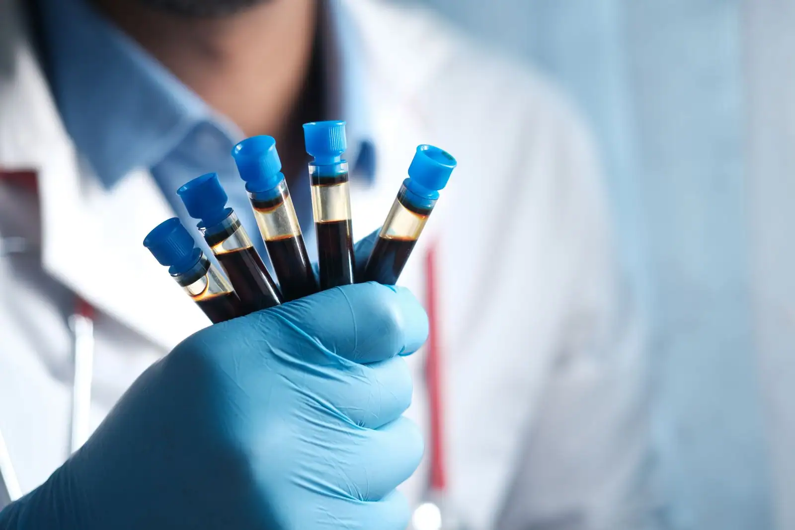 Main gantée d'un soignant tenant plusieurs tubes de prélèvement sanguin dans un laboratoire.